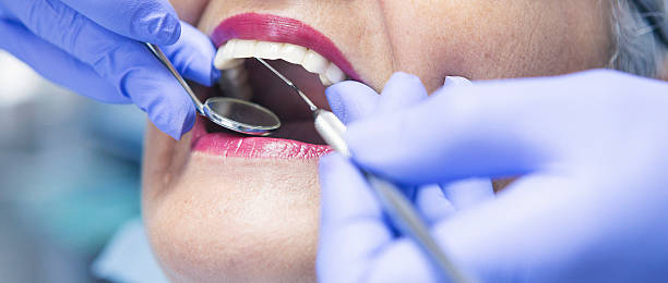 Best Emergency Gum Treatment in Beverly, OH